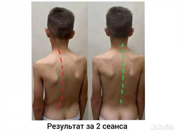 Массаж лечебный релакс