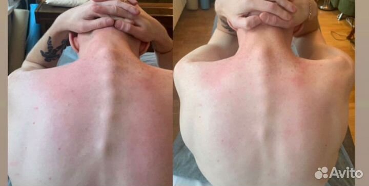 Массаж. Мануальный, классический. Опыт 20 лет