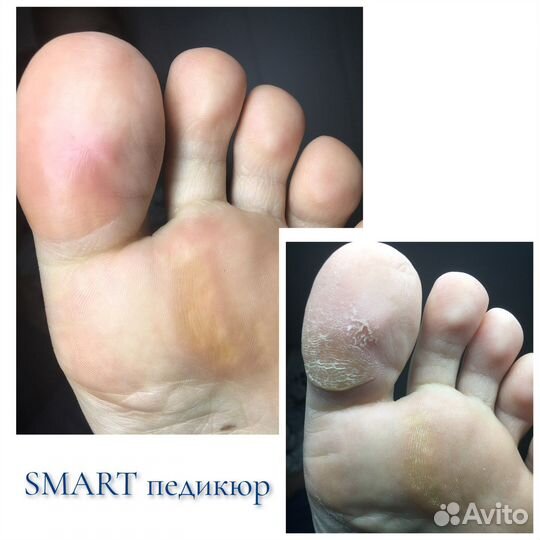 SMART педикюр, маникюр Абакан