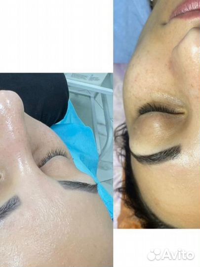 Отбеливающая маска для лица