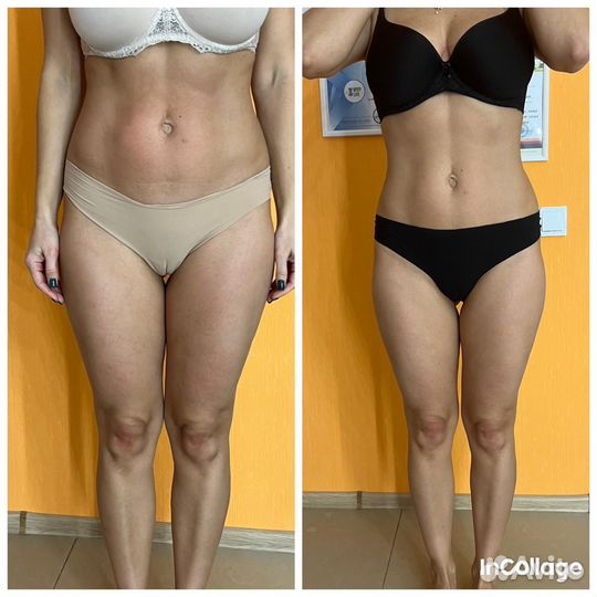 Аппаратный,вибрационно-роликовый массаж,кавитация