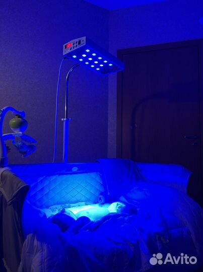 Фотолампа от желтушки