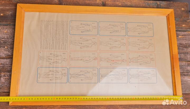 Медицинский плакат в рамке