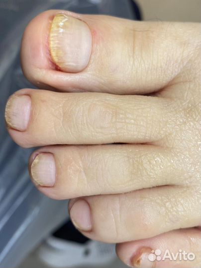 Услуги подолога