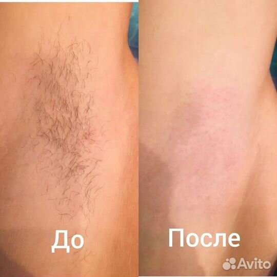 Ищу Модели на Шугаринг