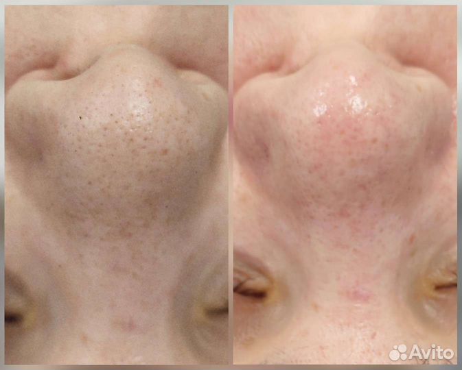 Косметолог с высшим медицинским