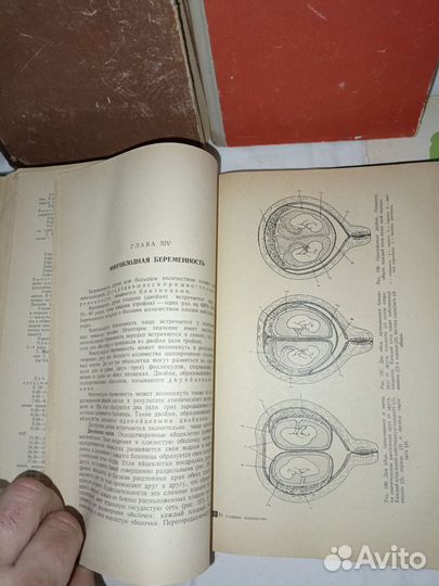 Книги СССР. Медицина