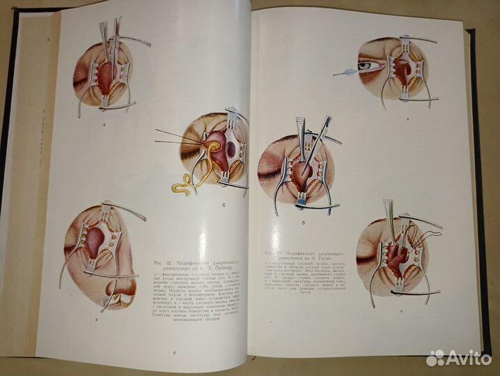 Руководство по глазной хирургии. Краснов. 1976