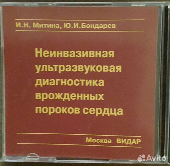 Уз-диагностика аномалий сердца плода. CD
