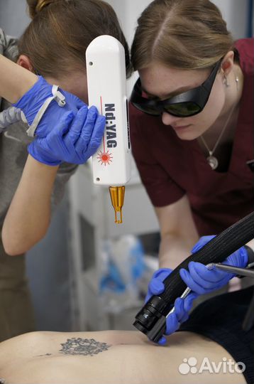 Удаление татуажа лазером