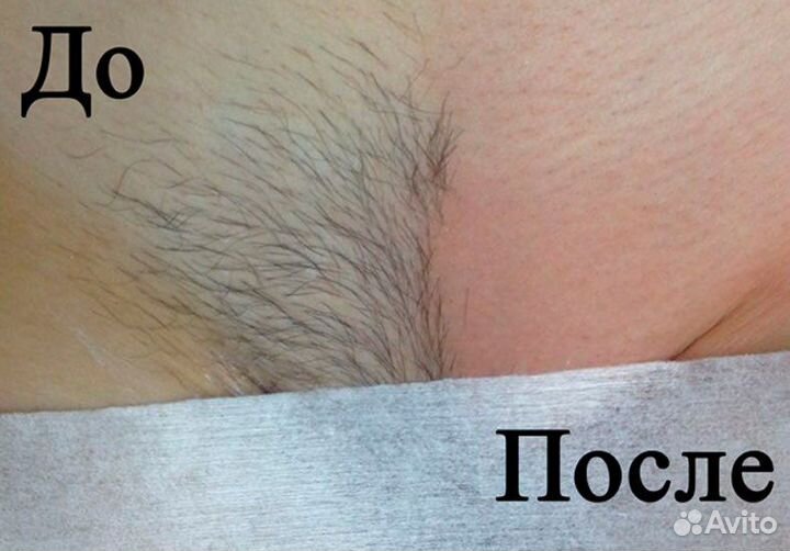 Шугаринг: бёдра