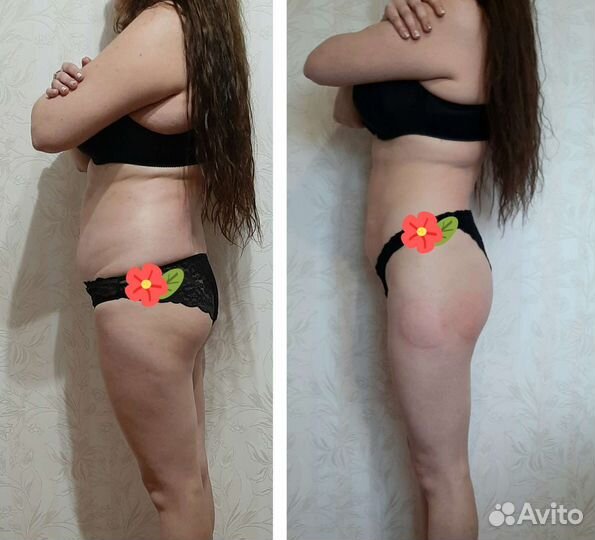 Массаж лица и тела. Lpg массаж. Коррекция фигуры