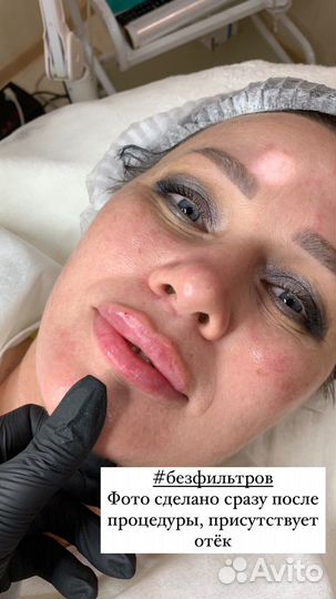 Косметолог/ чистки/пилинги/депиляция/аппараты