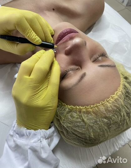 Обучение электроэпиляции