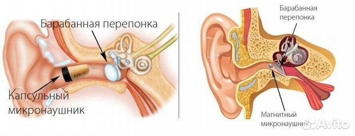 Микронаушники с камерой