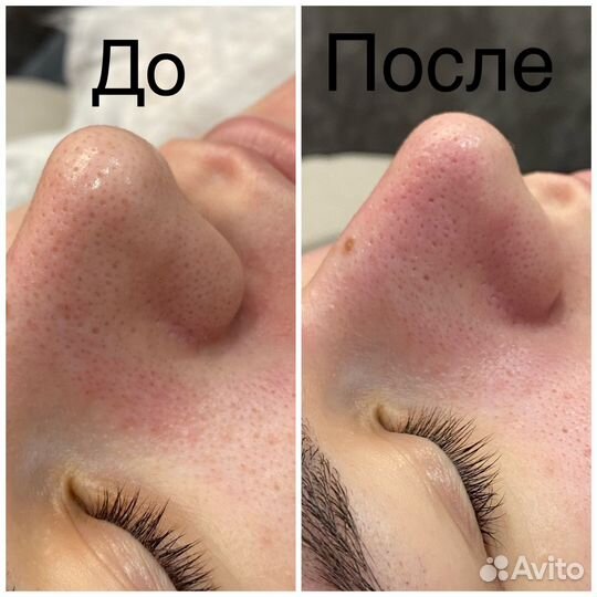 Косметолог эстетист