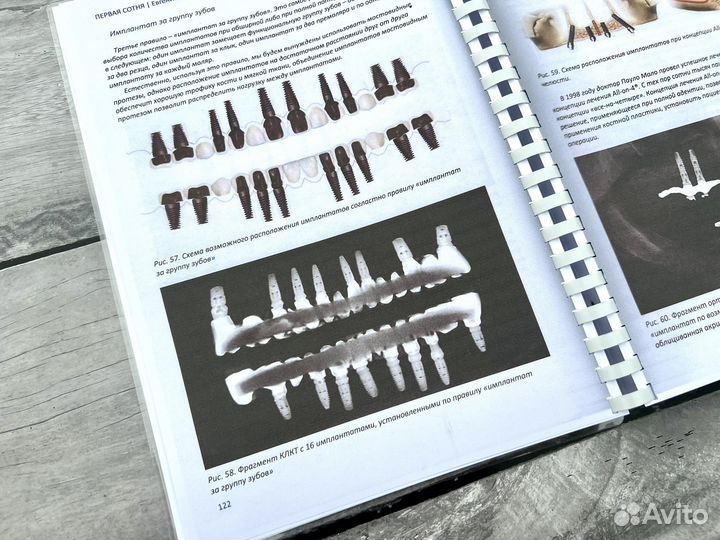 Первая сотня