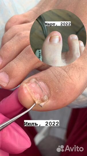 Подолог с выезжом на дом