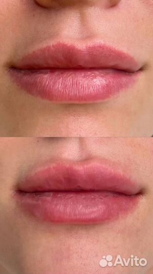 Модели на удаление тату и некачественного татуажа