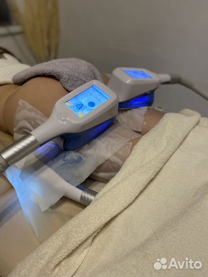 Криолиполиз услуги