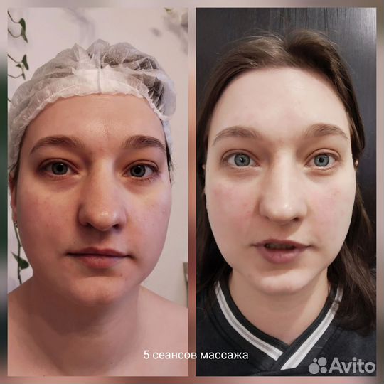 Массаж лица, косметология Мурино /Девяткино/ Бугры
