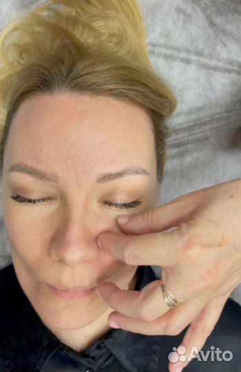 Правка черепа. Головные боли. Шумы в голове