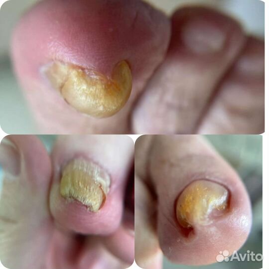 Педикюр/Подология