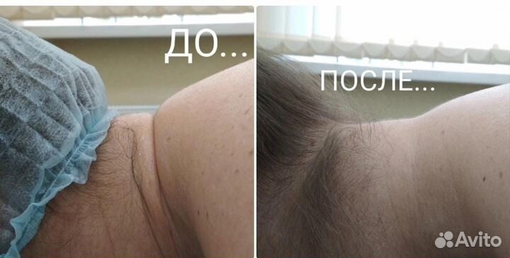 Массаж биоэнергетический