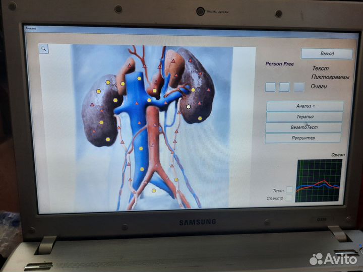 Диагностический аппарат брт биотест метатрон