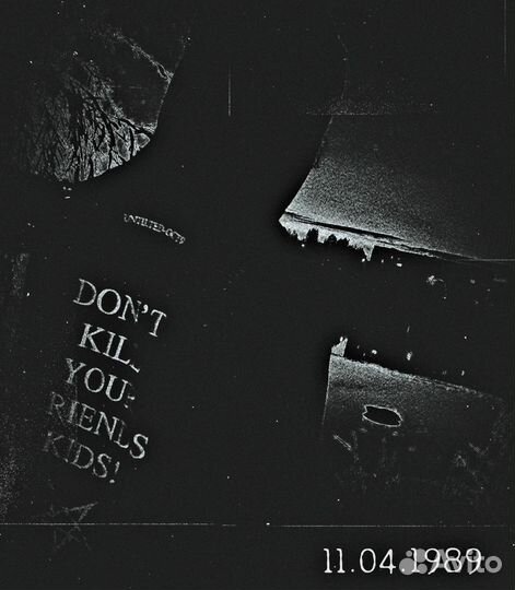 Conjunctiva untilted oct9 part 2