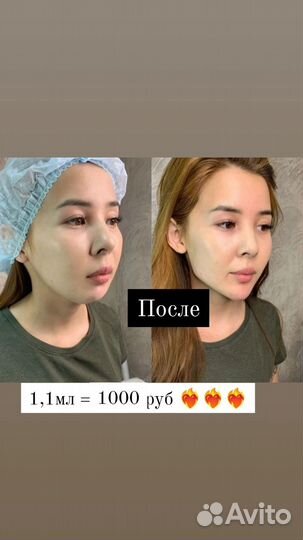 Услуги косметолога