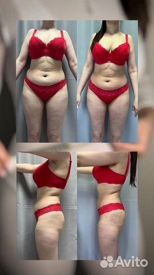 Lpg массаж, ручной массаж, кавитация, вибромассаж