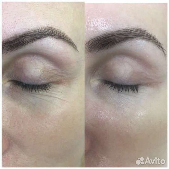 Скульптурный массаж лица