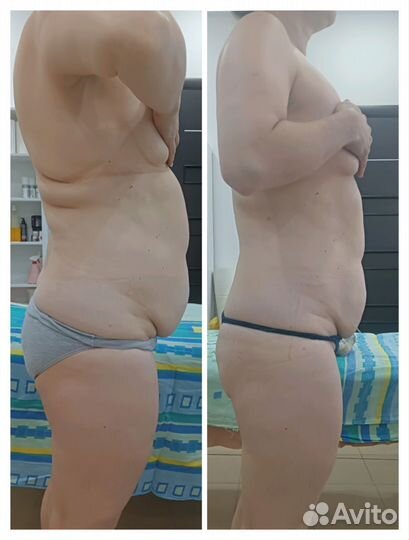 Массаж. Аппаратная коррекция фигуры. Снижение веса