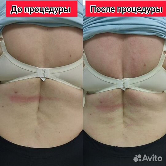 Здоровая спина