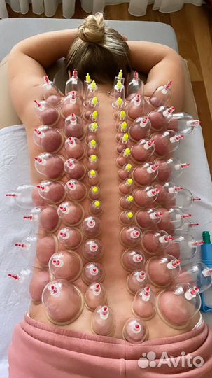 Баночный вакуумный массаж