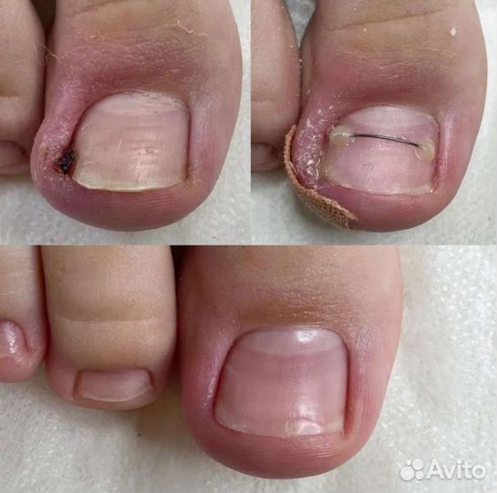 Подолог/педикюр