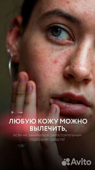 Лечение акне аппаратом навсегда