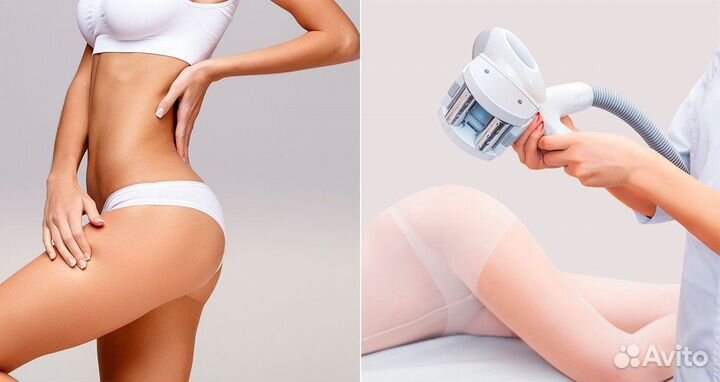 Курс LPG массажа 10 сеансов по 45 мин