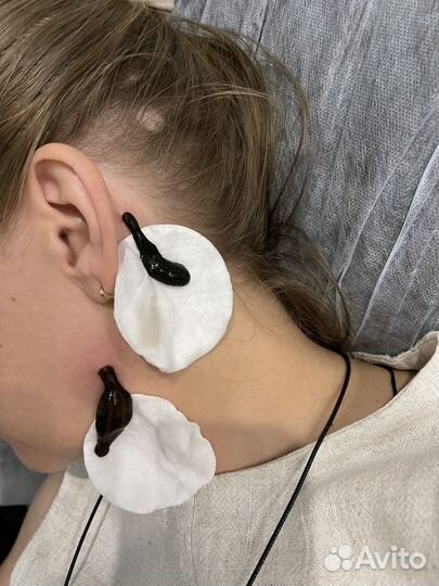 Купон на гирудотерапию