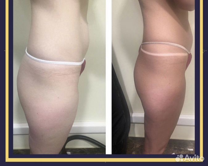 Моментальный загар