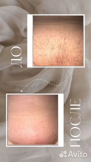 Шугаринг/Ваксинг