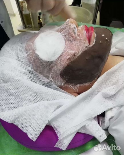 Дарсонвализация