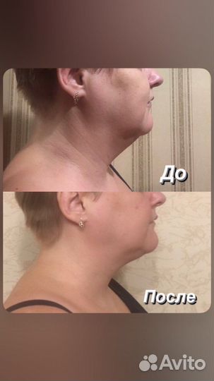 Массаж лица и тела