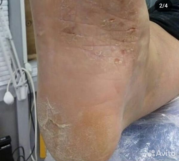 Маникюр Педикюр