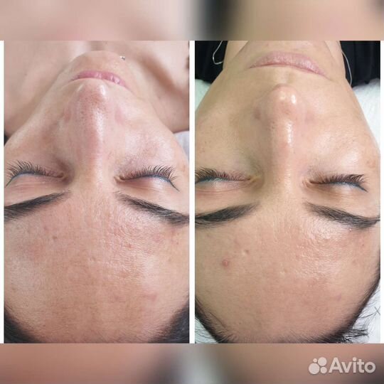 Услуги косметолога нужны модели