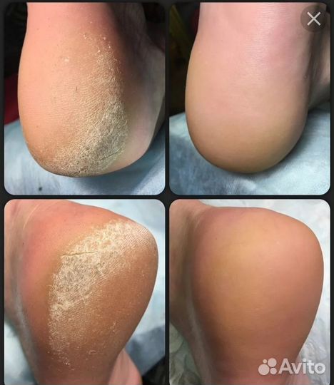 Массаж релакс+Баня.Массаж всего тела