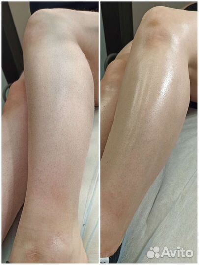 Шугаринг. Воск. Владимира Невского 17