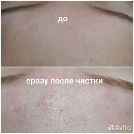 Услуги