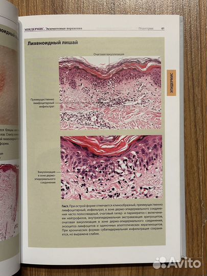 Атлас дерматопатологии Бург Кемпф Куцнер